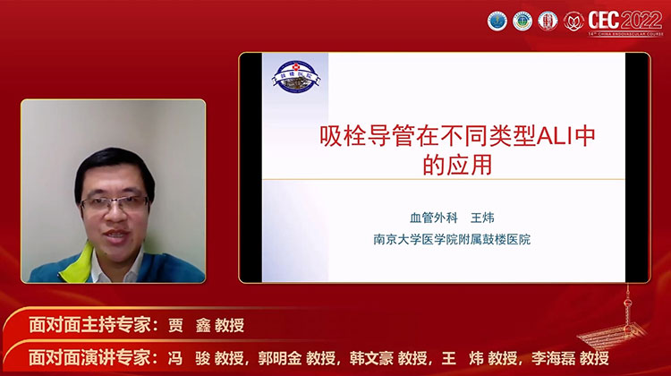 吸栓导管在不同类型ALI中的应用-王炜