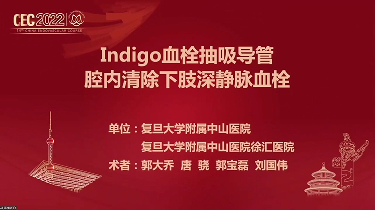 血栓抽吸导管腔内减容治疗下肢动脉血栓性病变-郭大乔，司逸