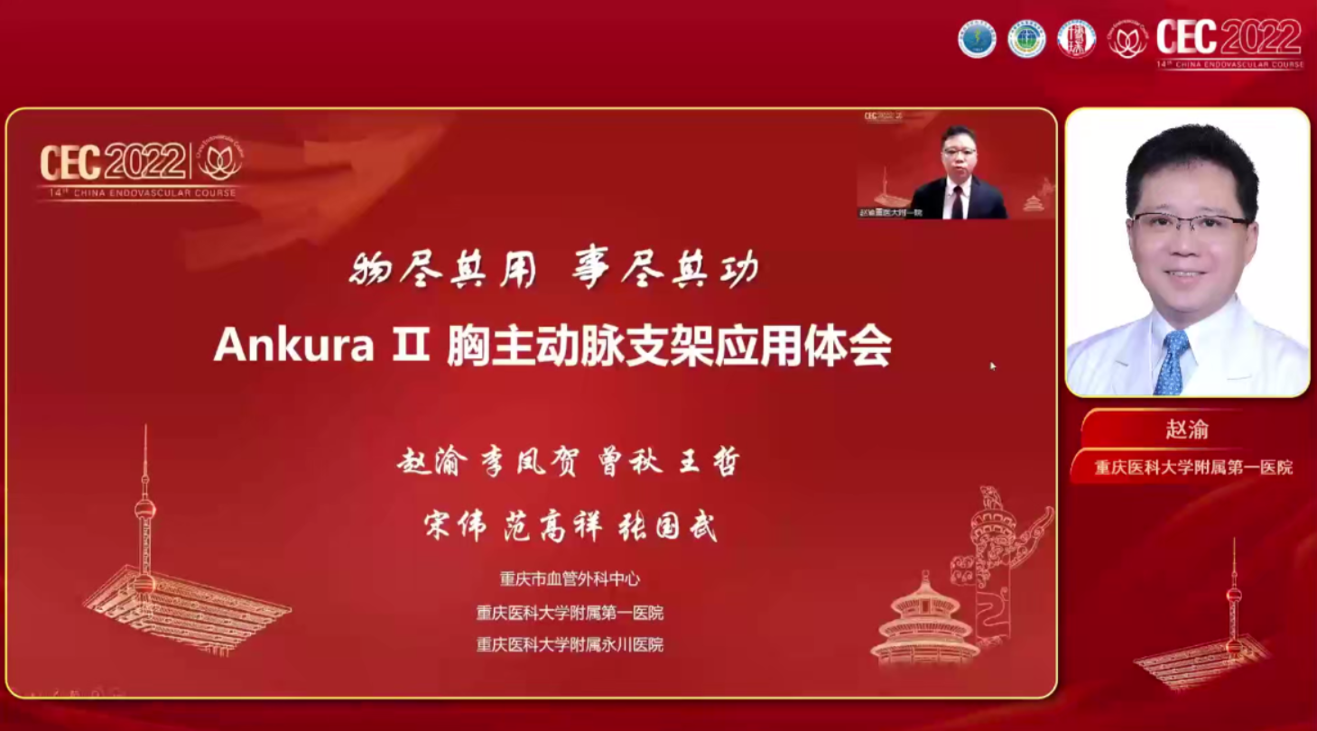 物尽其用，事尽其功&mdash;Ankura II 胸主动脉支架应用体会-赵渝