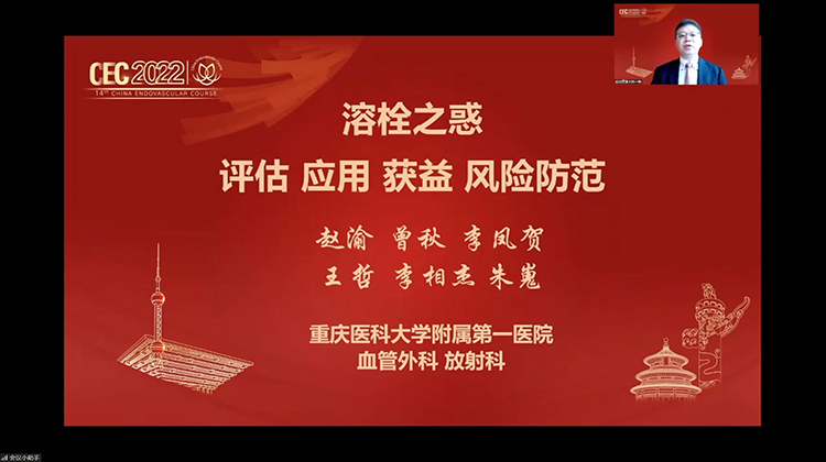 溶栓之惑 评估、应用、获益及风险防范-赵渝