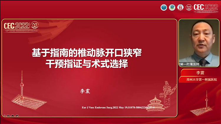 基于指南的椎动脉开口狭窄干预指证与术式选择-李震