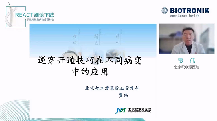 逆穿开通技巧在不同病变中的应用-贾伟