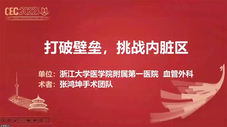原位开窗技术在胸腹主动脉内脏分支的应用-张鸿坤