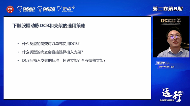 DCB与BMS在股腘动脉腔内治疗的关键问题解读-李承志