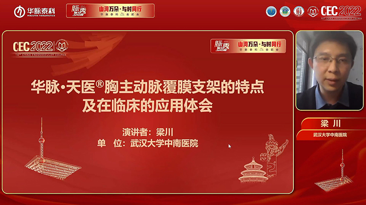 华脉天医胸主动脉覆膜支架的特点及在临床应用体会-梁川