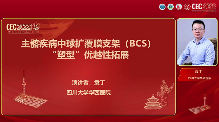 主髂疾病中球扩覆膜支架的&ldquo;塑型&rdquo;优越性拓展-袁丁
