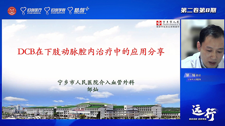 DCB在下肢动脉腔内治疗中的应用分享-邹灿