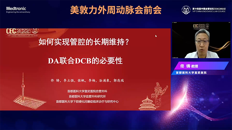 如何实现管腔的长期维持DA联合DCB的必要性-佟铸