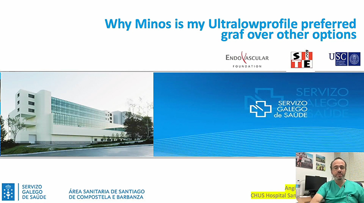 Minos&reg;覆膜支架 Low Profile的最佳选择-Nilo Mosquera