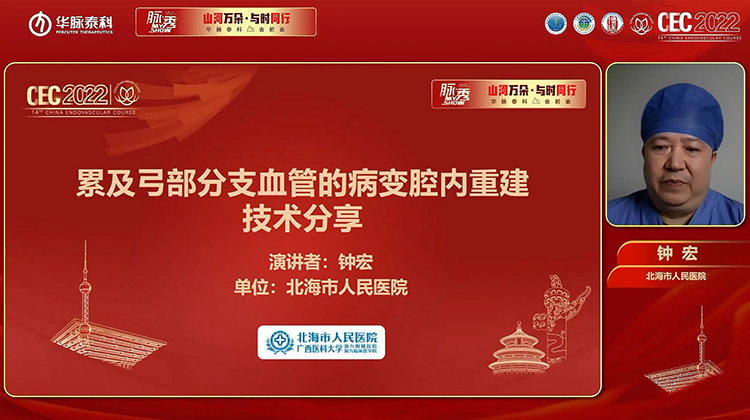 累及弓部分支血管的病变腔内重建技术分享-钟宏