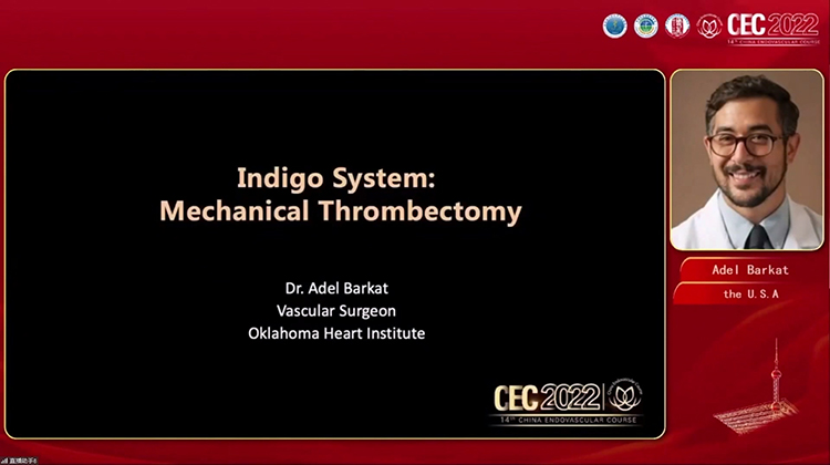 新型机械血栓切除技术及应用 New mechanical thrombectomy technology and applicaiton-Adel Barkat