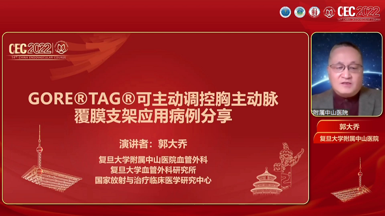 GORE&reg; TAG&reg;可主动调控胸主动脉覆膜支架应用病例分享-郭大乔