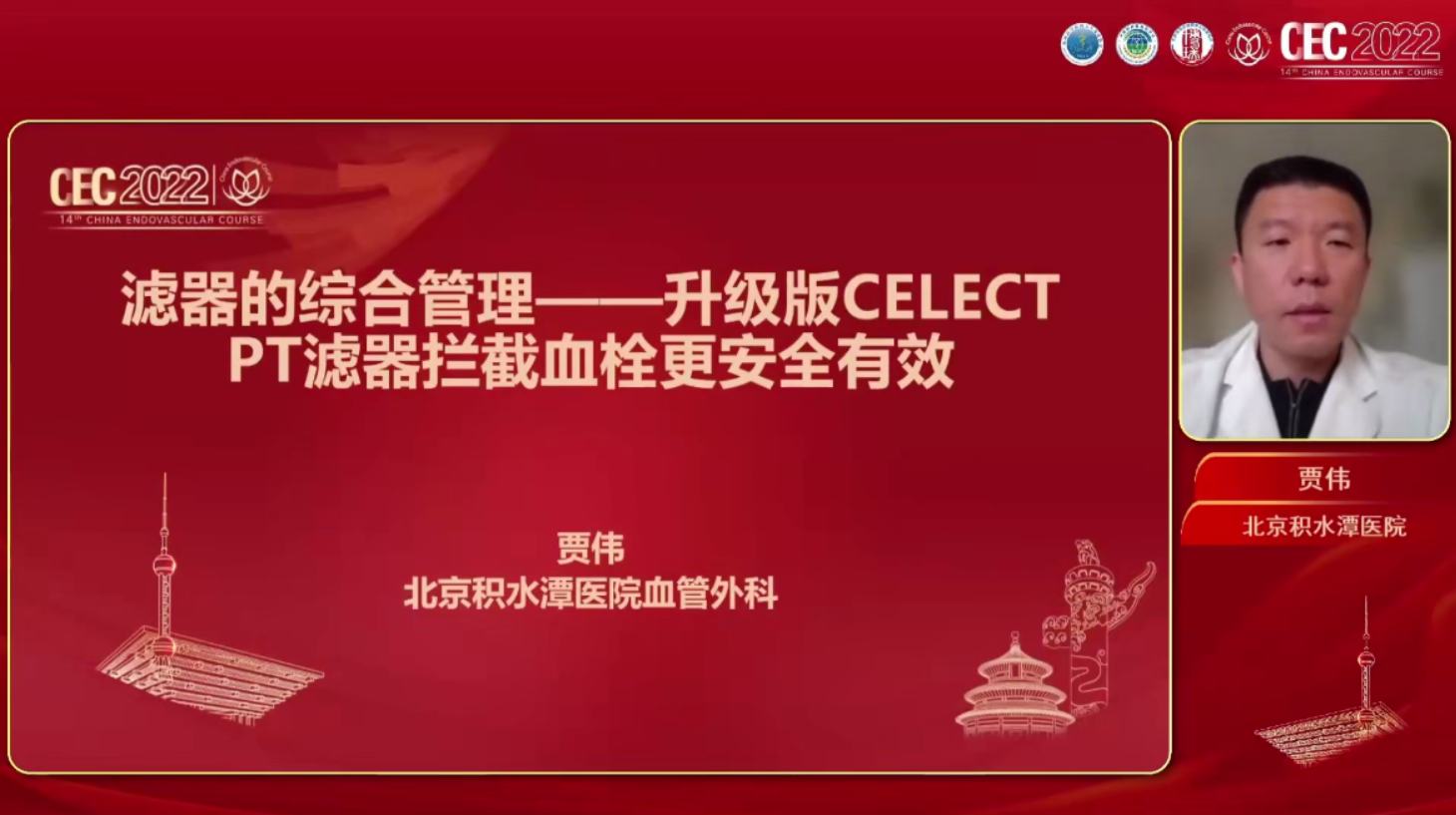 升级版SELECT PT滤器拦截血栓更安全有效-贾伟