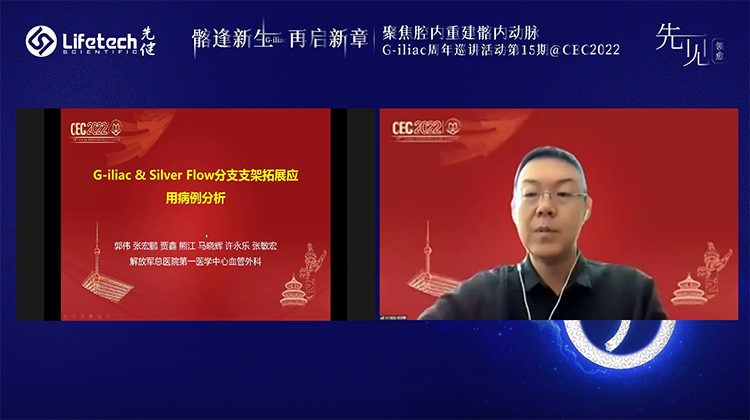 G-iliac&SilverFlow分支支架拓展应用病例分析-张宏鹏