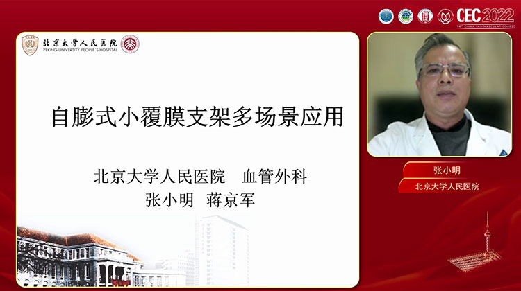 戈尔Viabahn自膨式小覆膜支架多场景应用-张小明