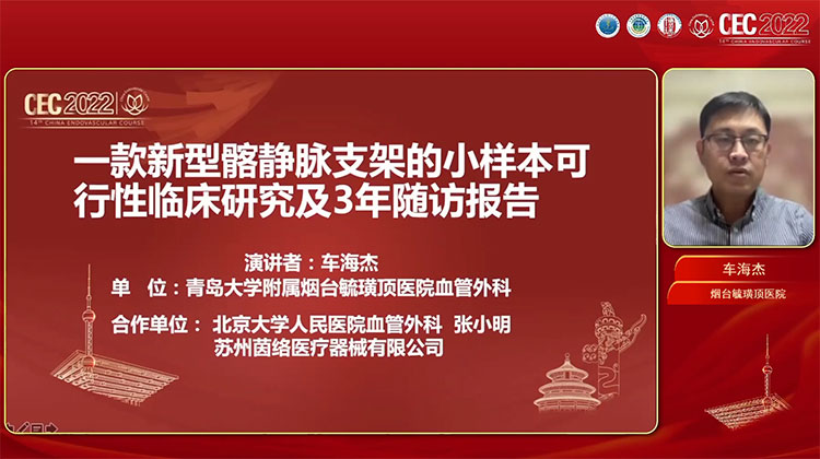 一款新型髂静脉支架的小样本可行性临床研究及3年随访报告-车海杰
