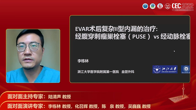 EVAR术后II型内漏的治疗：经腹穿刺瘤巢栓塞VS经动脉栓塞-李栋林