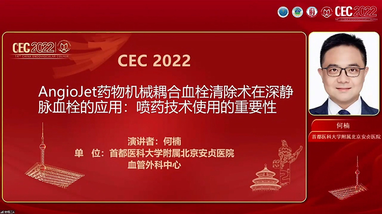 AngioJet药物机械耦合血栓清除术在深静脉血栓的应用：喷药技术使用的重要性-何楠