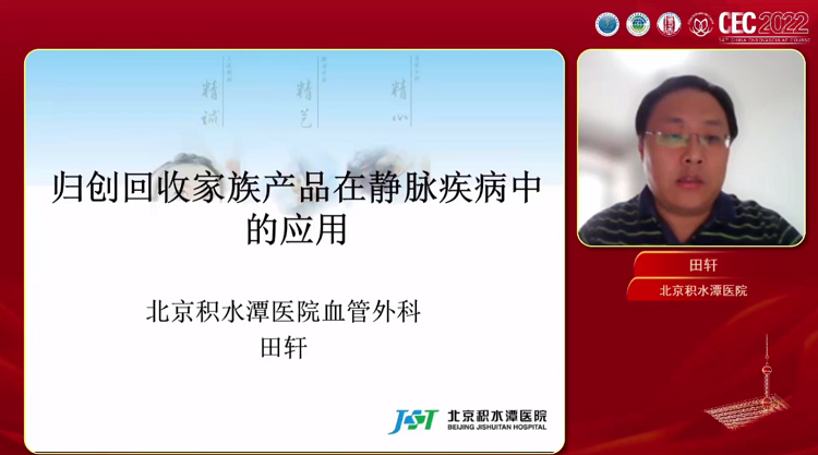 归创医疗静脉抓捕组合解决方案-田轩