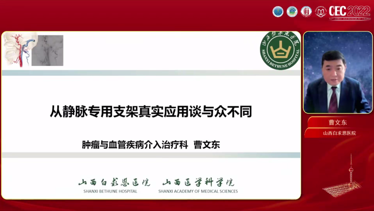 从静脉专用支架真实应用谈与众不同-曹文东