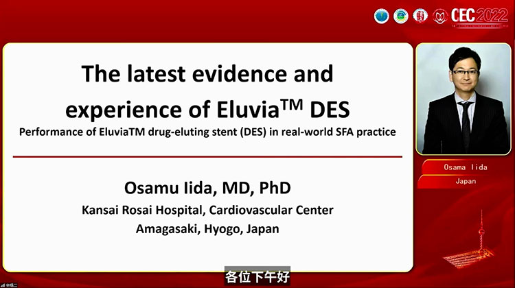 Capsicum研究：药物洗脱支架（DES）和药涂球囊（DCB）的比较 The Capsicum Study Comparison between DES and DCB-Osama Iida