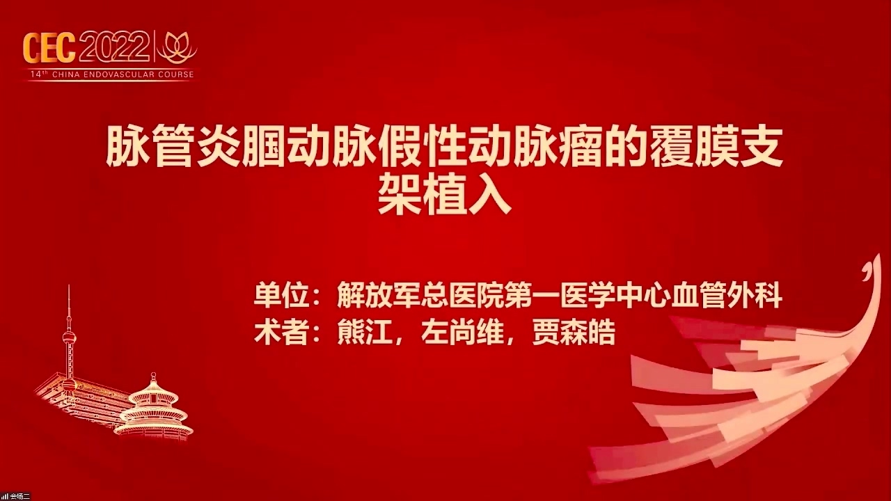 脉管炎腘动脉假性动脉瘤的覆膜支架置入-熊江