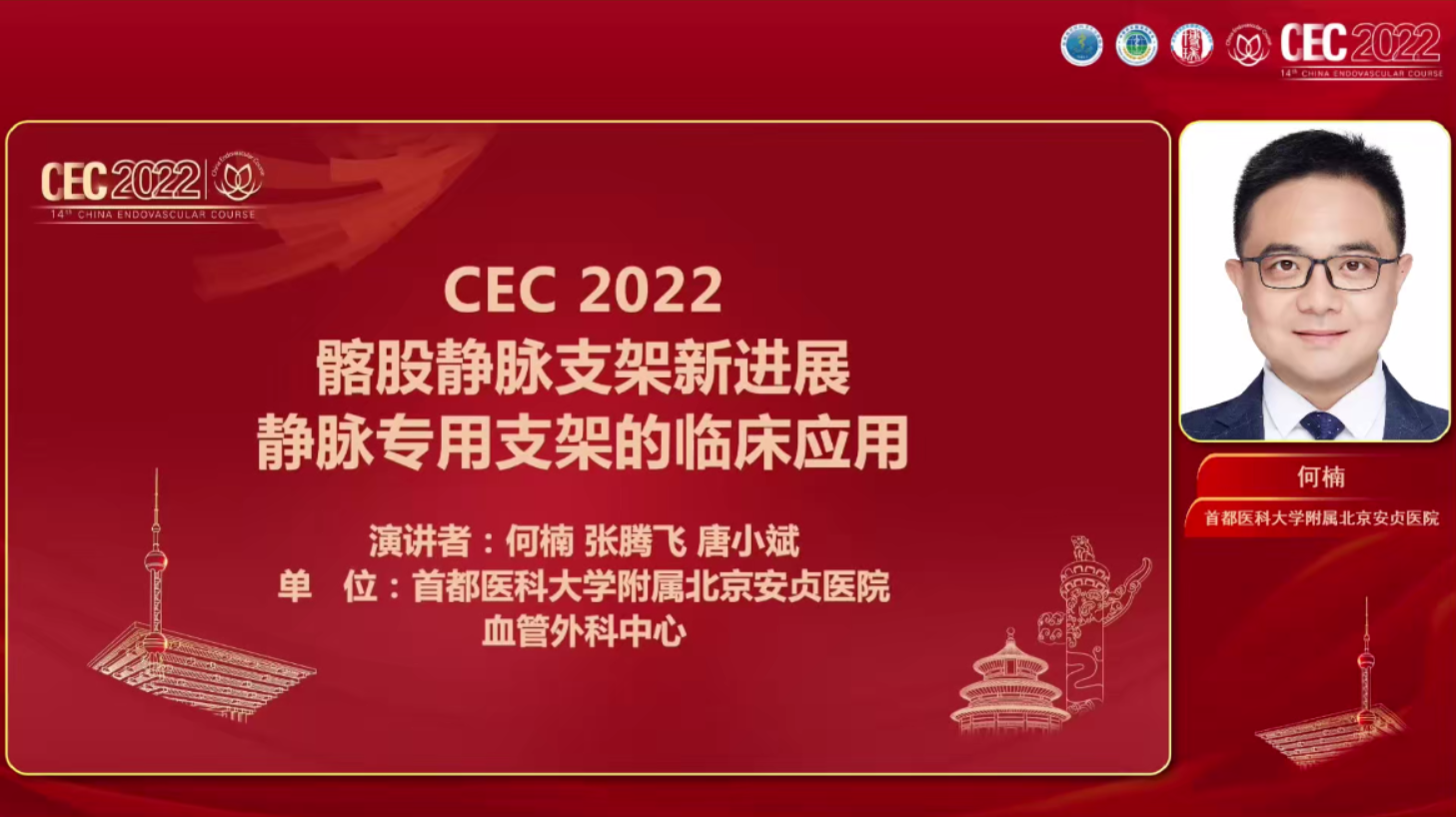 BD VENOVO 静脉专用支架的临床应用-何楠