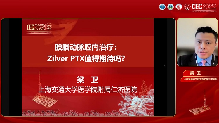 股腘动脉腔内治疗：Zilver PTX值得期待吗-梁卫
