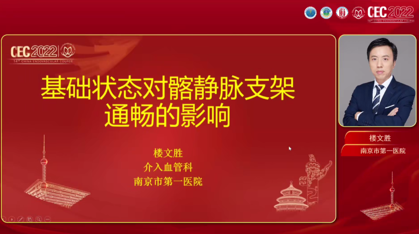 基础状态对髂静脉支架通畅性的影响-楼文胜
