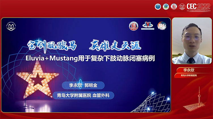 宝剑配骏马，英雄走天涯&mdash;&mdash;Mustang+Eluvia用于复杂PAD病例一例-李永欣