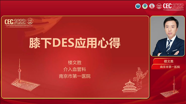 膝下动脉DES应用心得-楼文胜