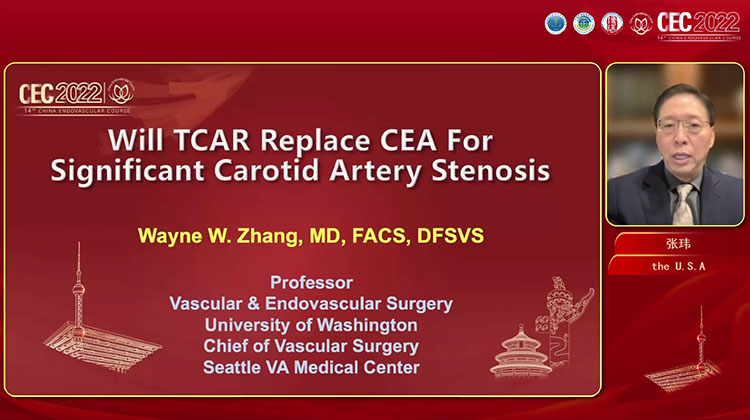 TCAR可以替代CEA治疗重度颈动脉狭窄吗？ Will TCAR replace CEA for significant carotid stenosis-张玮