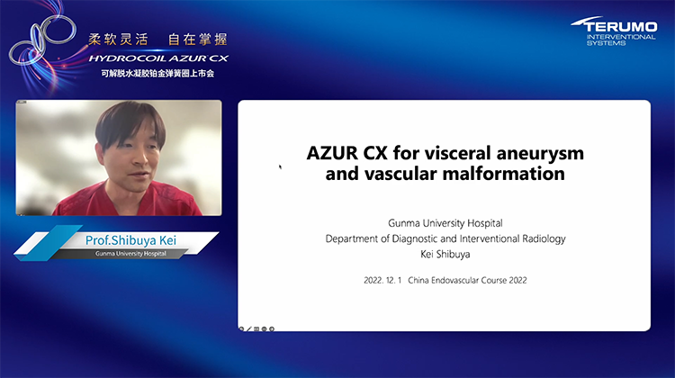 Azur CX 在内脏动脉瘤的应用-渋谷 圭