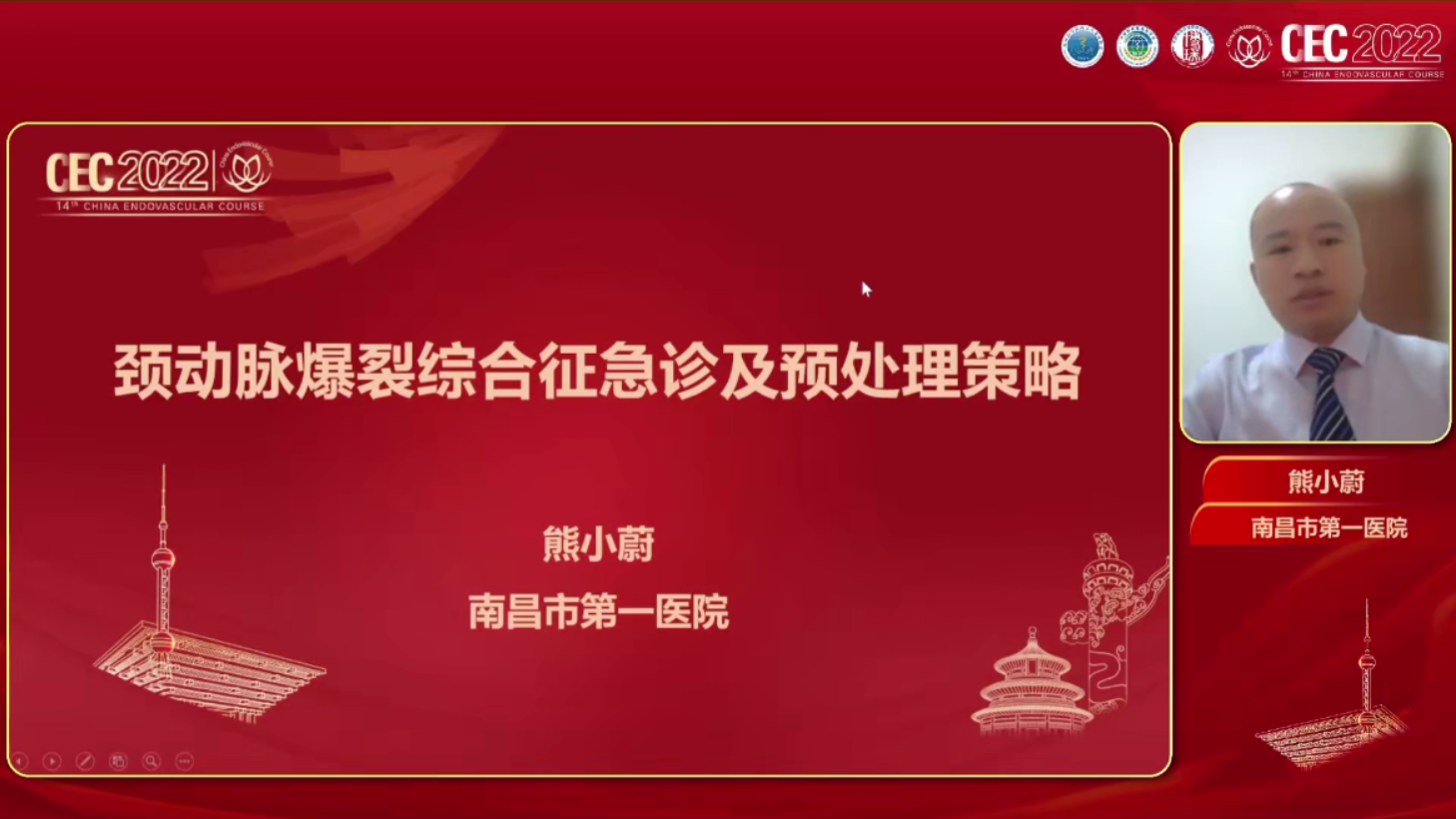颈动脉爆裂综合征急诊及预处理策略-熊小蔚
