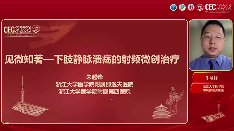 见微知著-下肢静脉性溃疡的射频微创治疗-朱越锋
