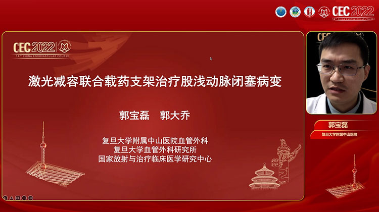 激光减容联合载药支架治疗股浅动脉闭塞病变-郭宝磊