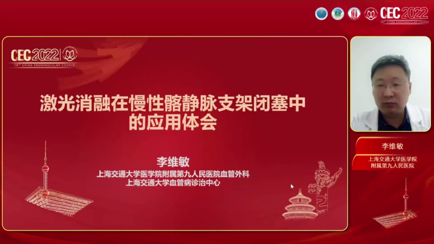 激光消融在慢性髂静脉支架闭塞中的应用体会-李维敏