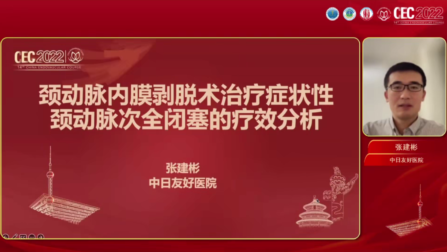 颈动脉内膜剥脱术治疗症状性颈动脉次全闭塞的疗效分析 -张建彬