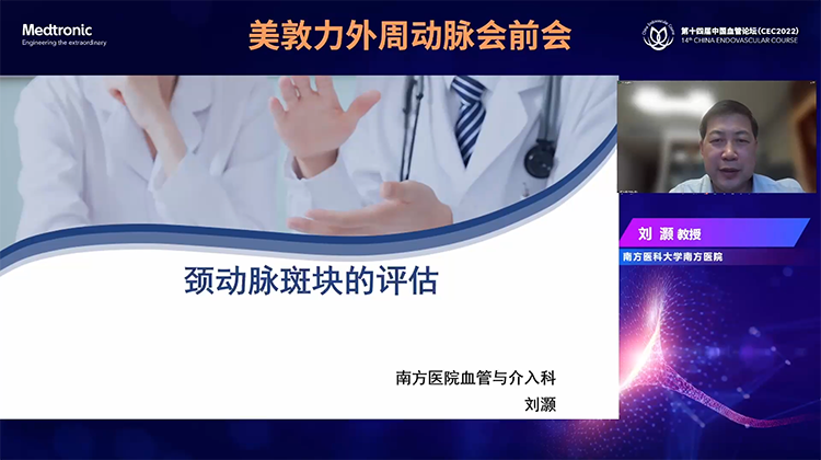 颈动脉斑块的评估-刘灏