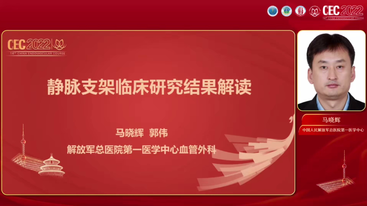 静脉支架临床研究结果解读-马晓辉