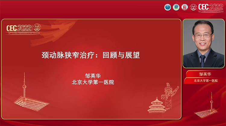 颈动脉狭窄治疗：回顾与展望-邹英华