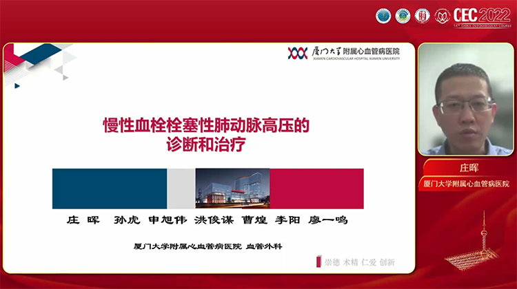 慢性血栓性肺动脉高压的诊治与介入治疗-庄晖