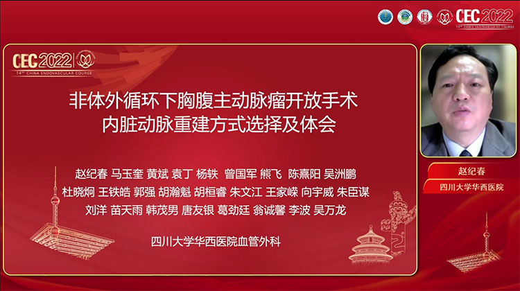 非体外循环下胸腹主动脉瘤开放手术内脏动脉重建方式选择及体会-赵纪春