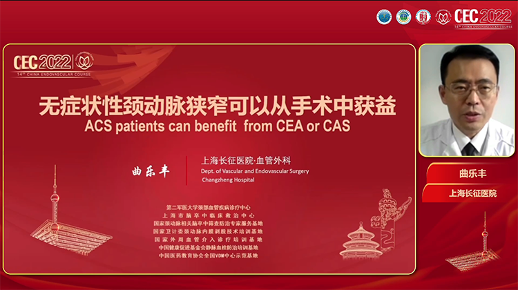 无症状性颈动脉狭窄可以从手术中获益-曲乐丰