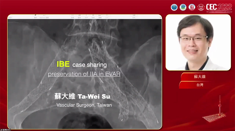 IBE case sharing-蘇大維