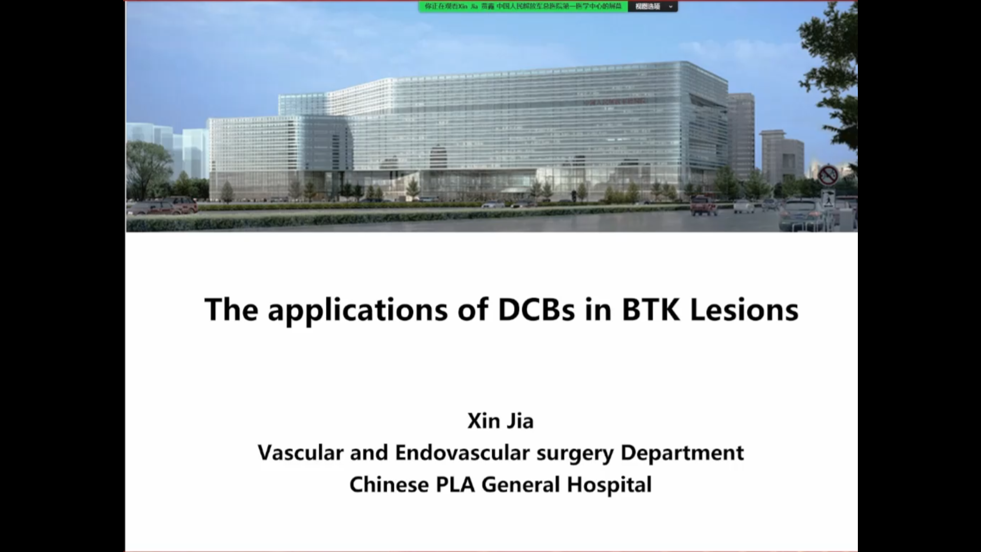药物涂层球囊在膝下血管的应用经验分享--贾鑫