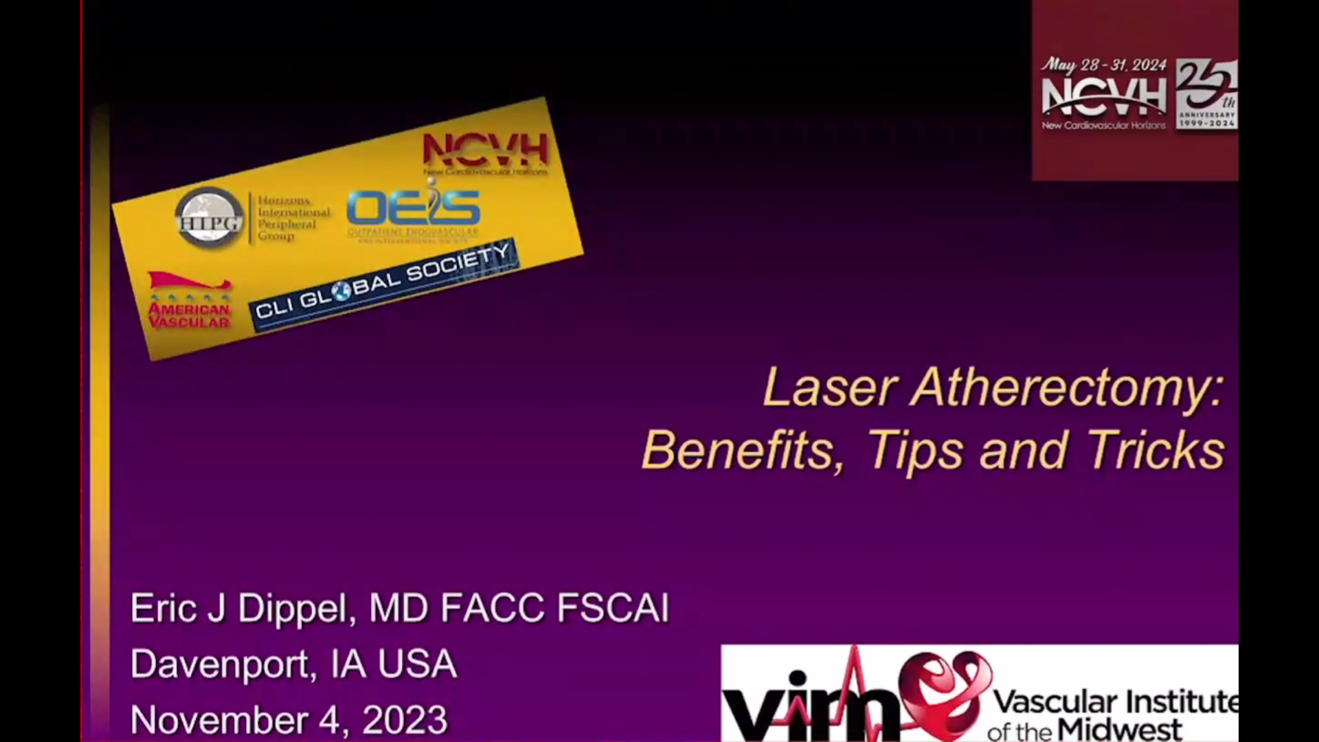 激光减容的优势、注意事项与诀窍--Eric Dippel