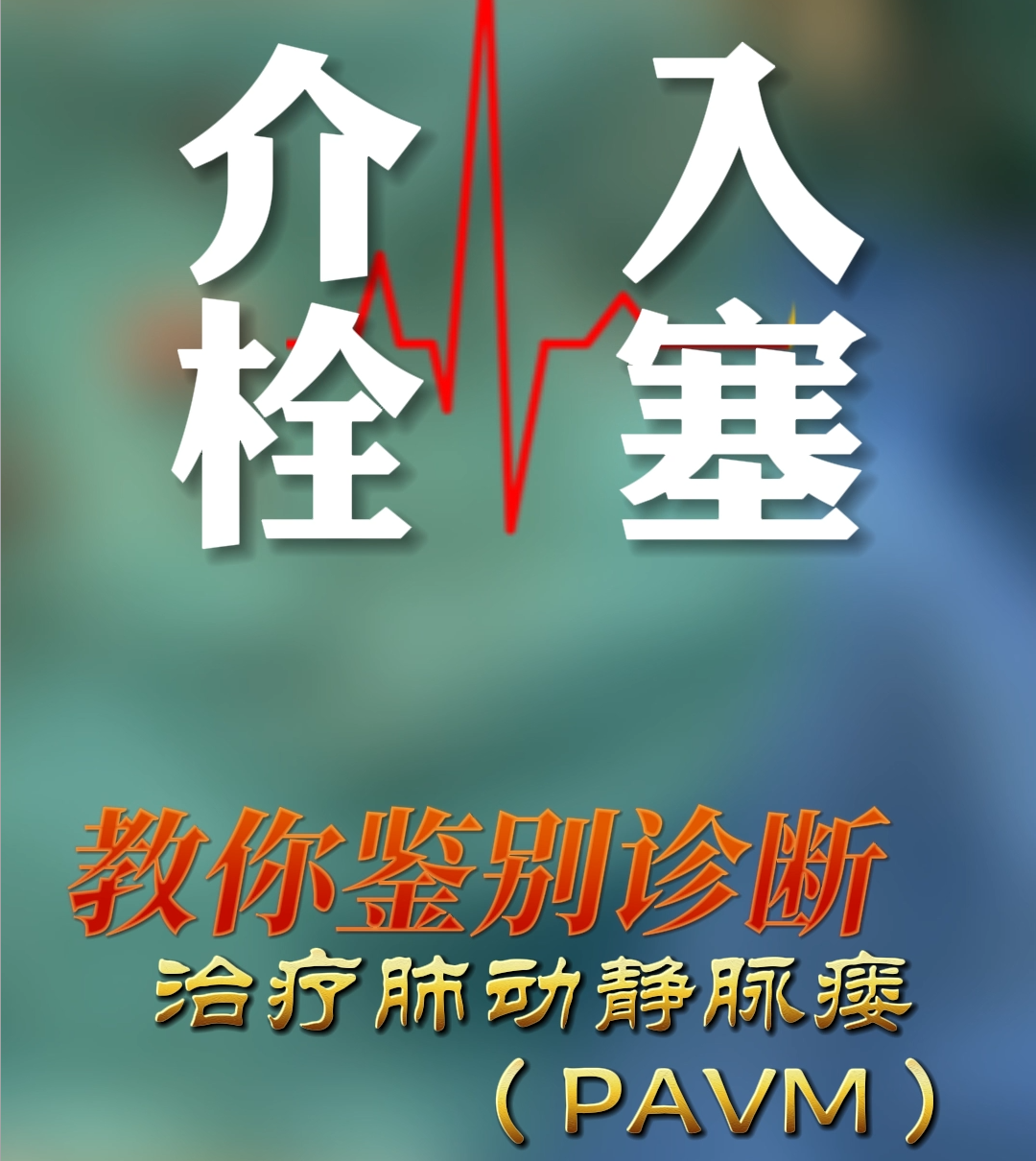 介入栓塞篇｜教你鉴别诊断治疗肺动静脉瘘（PAVM）