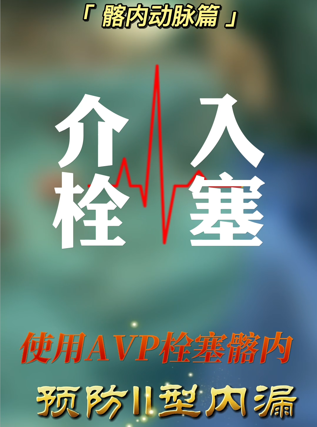 介入栓塞篇｜髂内动脉