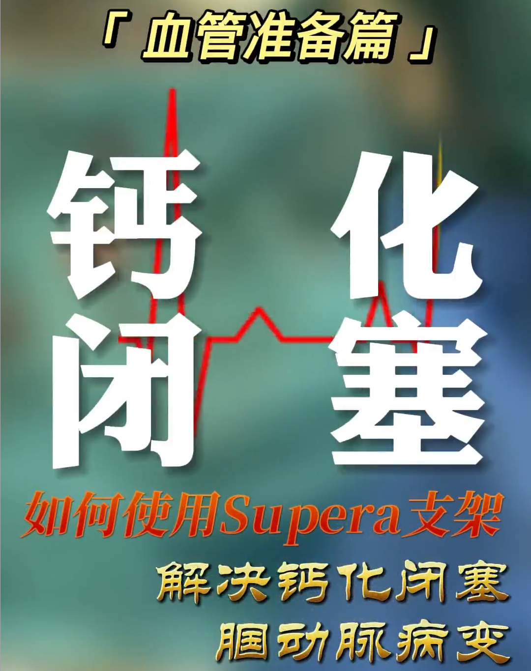 血管准备篇｜钙化闭塞